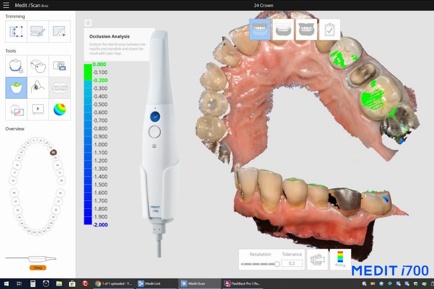 escaner-3d-intraoral-medi-i700-mexico